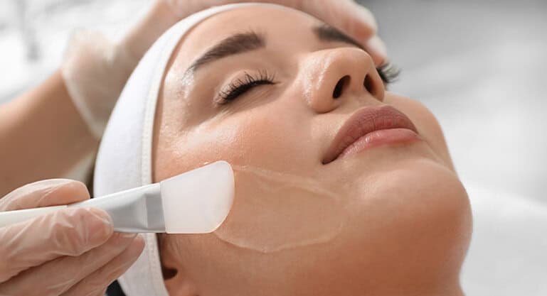 Kimyasal Peeling