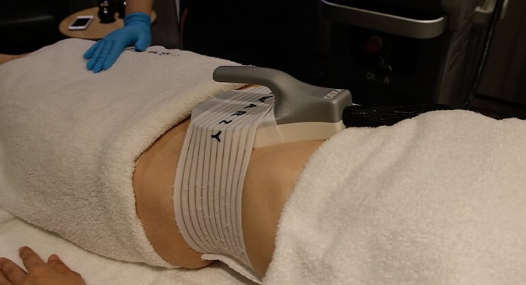 Schwarzy Manyetik Stimulasyon