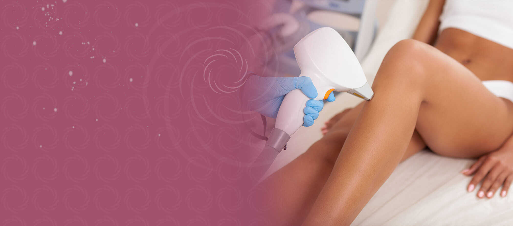 Lazer Epilasyonun Cilt Tipine Göre Farklı Etkileri lazer epilasyon bölgeleri