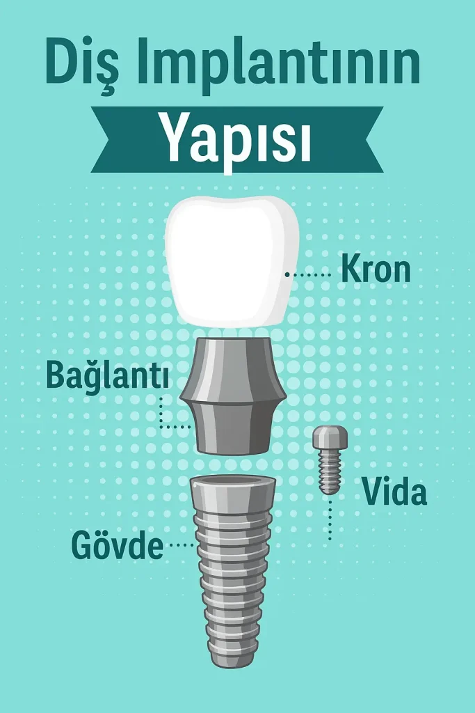 Başarısız İmplant Belirtileri Nelerdir?