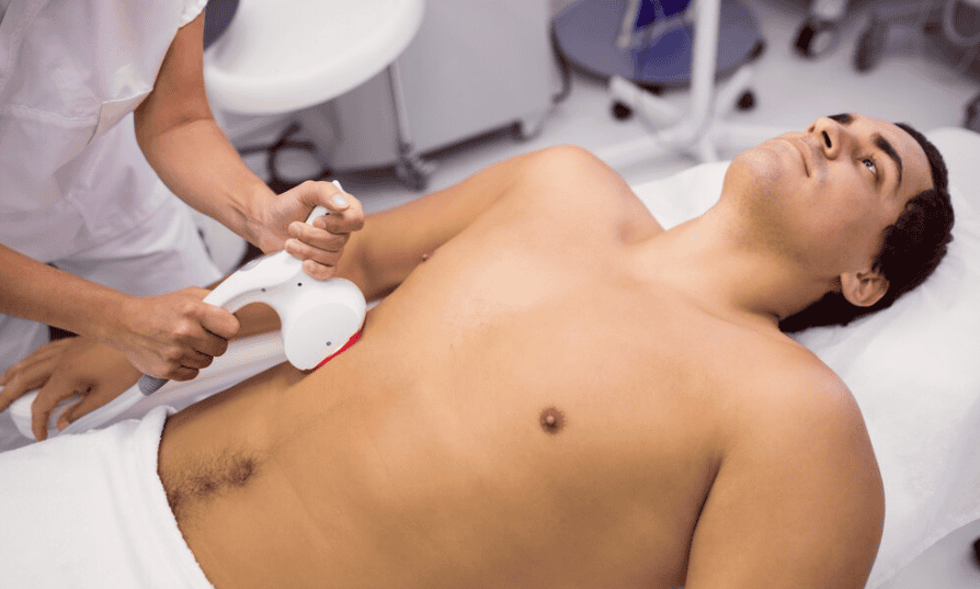 Lazer Epilasyon Hangi Bölgelere Uygulanmaktadır?