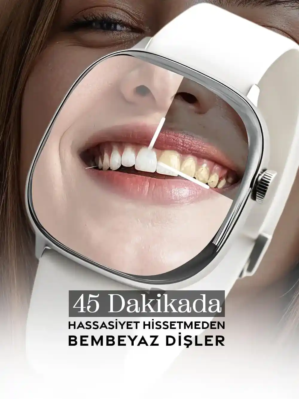 disbeyazlatma-mobil-banner-1 (1)