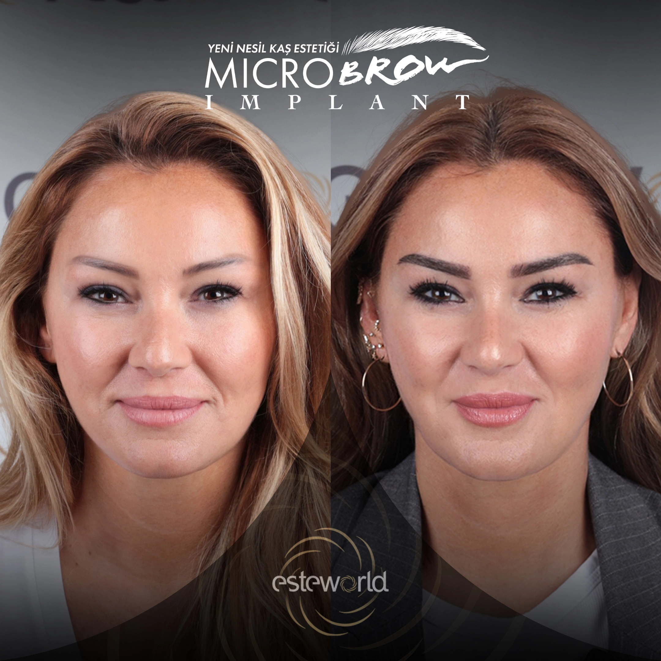 Pınar Altuğ’un Yeni Güzellik Sırrı: MicroBrow Kaş Estetiği