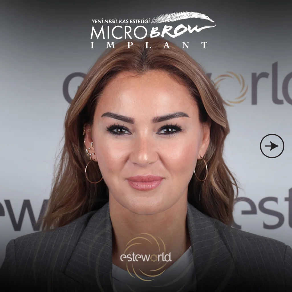 Pınar Altuğ’un Yeni Güzellik Sırrı: MicroBrow Kaş Estetiği