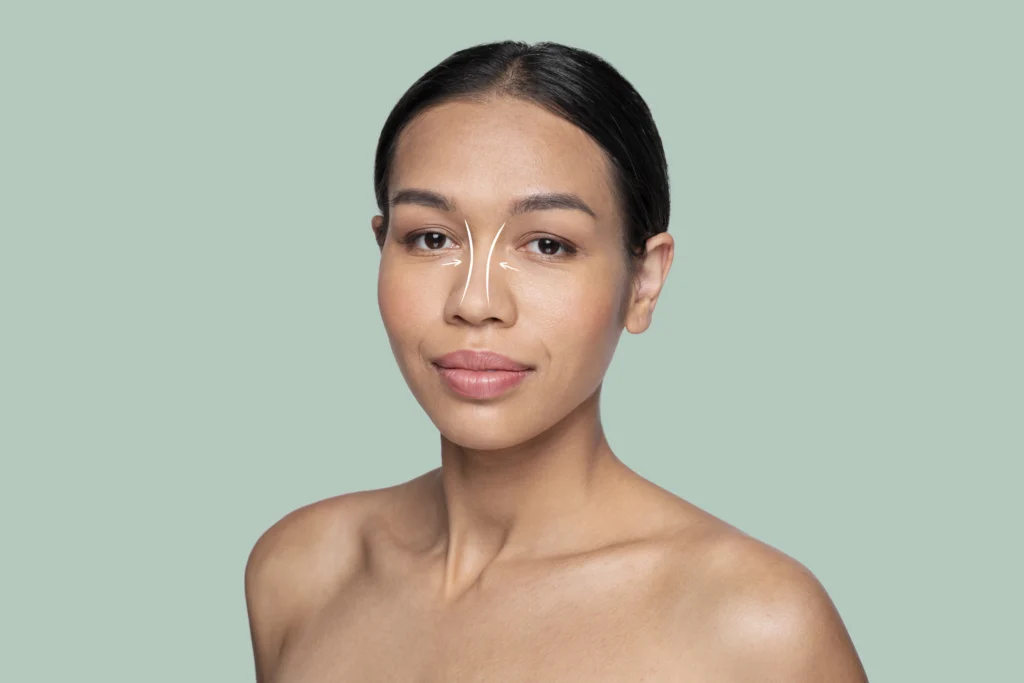 Revizyon Burun Estetiği