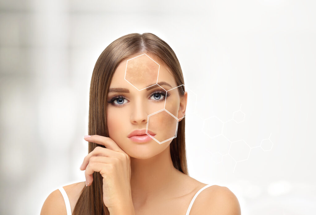 Gold Mix Leke Tedavisi