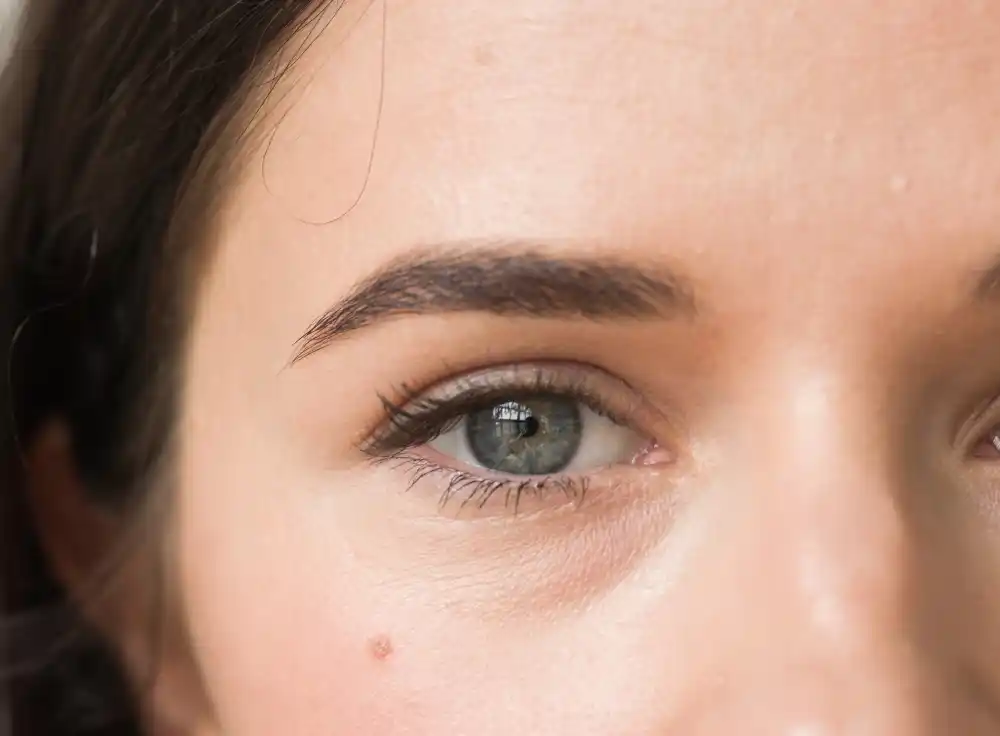 Göz Altı Işık Dolgusu