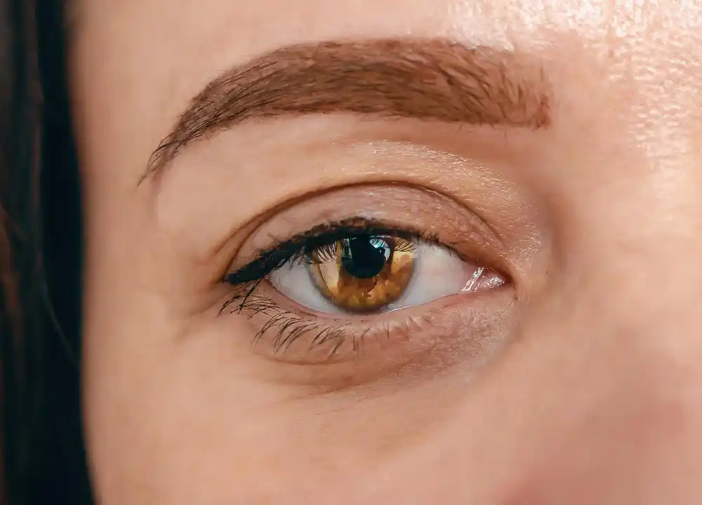 Göz Altı Işık Dolgusu