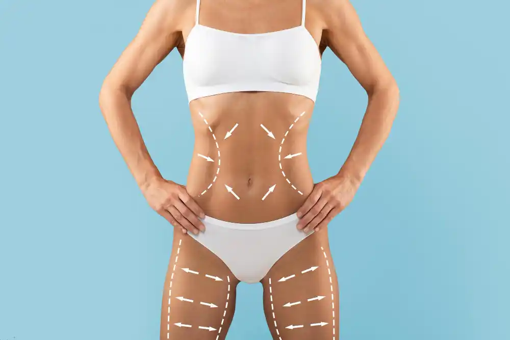 Sıcak Lazer Lipoliz