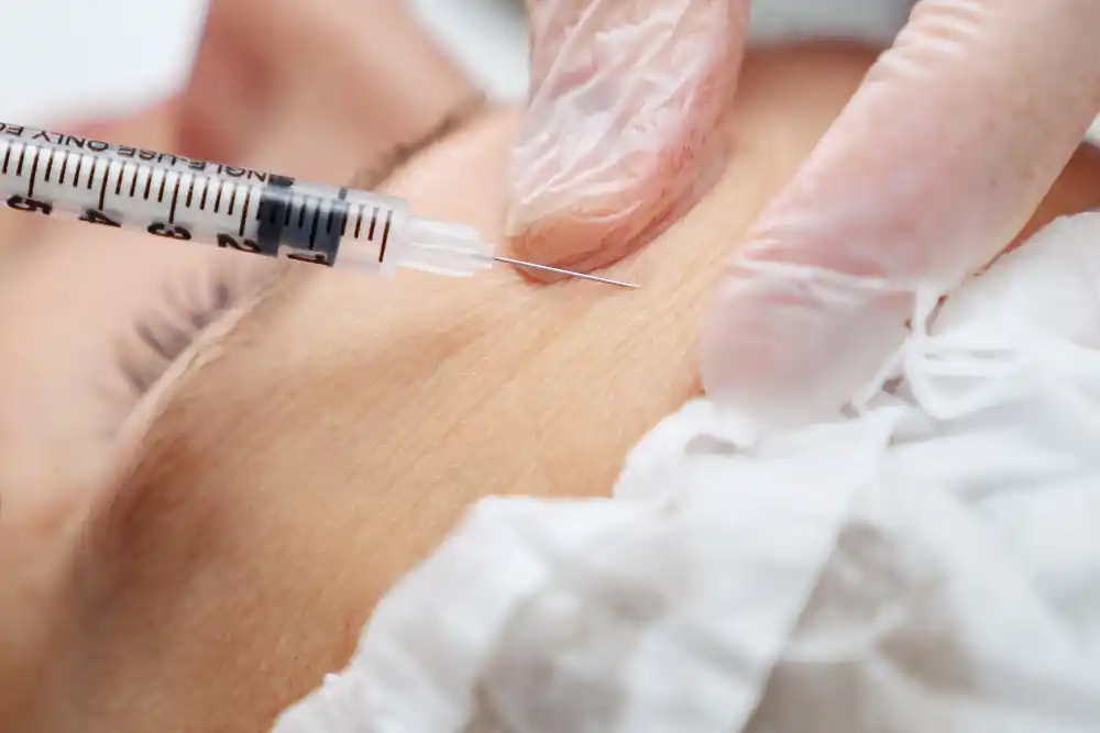 Botoksla Terleme Tedavisi