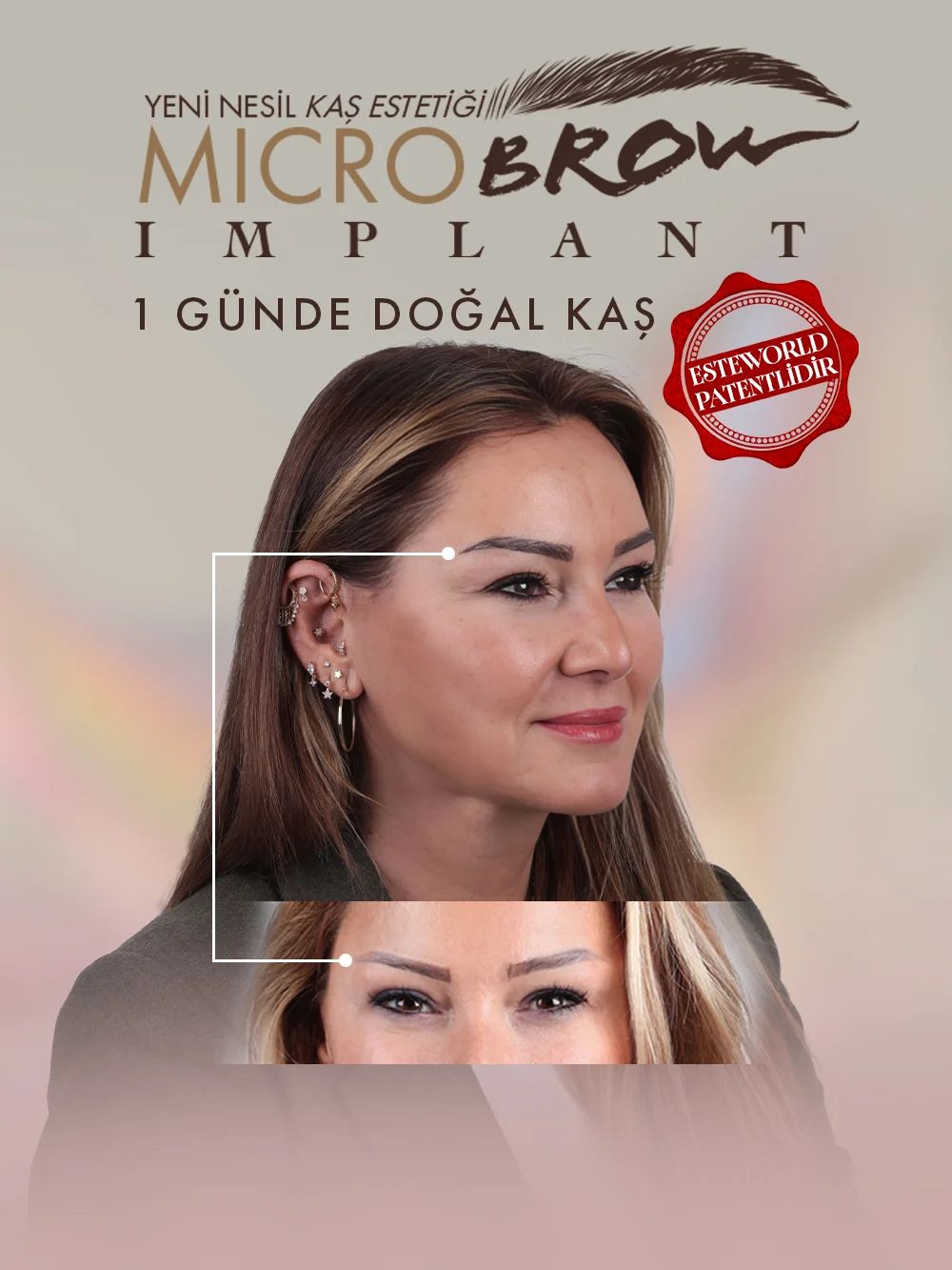 microbrowmobile